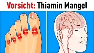 7 Anzeichen für akuten Thiamin-Mangel...