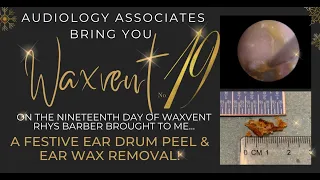 EARDRUM PEEL & EAR WAX REMOVAL - EP538