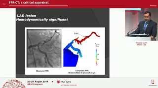 FFR CT a critical appraisal