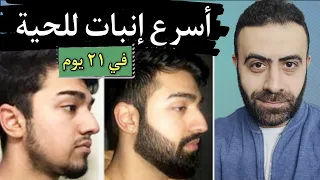 اسرع علاج لانبات اللحية في ٢١ يوم نتيجة اكيدة هاتشوفها بعنيك - HOW TO GROW A BEARD FAST