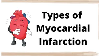 Types of MI (Myocardial Infarction)! #doctors #medical #medicine #plab #neetpg #mrcp #usmle #shorts