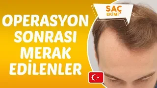 Saç Ekimi operasyonu sonrası dikkat edilmesi gerekenler nelerdir? - Dr. Hamid AYDIN