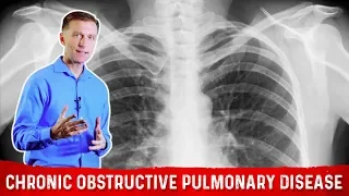 Intermittent Fasting and Chronic Obstructive Pulmonary Disease (COPD) – Dr.Berg