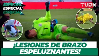 ¡ATERRADORAS! Las lesiones de brazo más recordadas en el futbol mexicano | TUDN