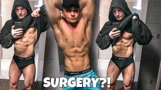 Getting Surgery? | MRI Results | RARE LEG WORKOUT