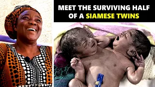 Meet the Surviving Half of a SIAMESE TWINS - Lady Evang. Rachael Ijaodola // IT HAPPENED TO ME Eps14