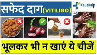 सफेद दाग (#Vitiligo/#Leucoderma) में क्या खाएं क्या न खाए?  | Kayakalp Global