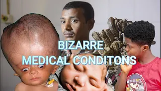 Strangest Medical conditions you need to know (rare genetic disorder)