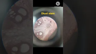 Dicot#stem#microscopic study