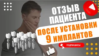 Отзыв пациента после установки 9 имплантов и удаления зубов за один прием. Стоматология Дентум