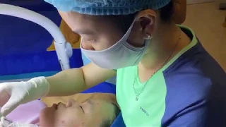 Blackhead Treatment -  SacDepSpa#194