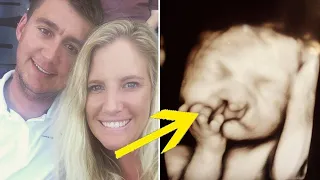 Parents Refuse To Abort ‘Deformed’ Baby — Look At Him 2 Years Later