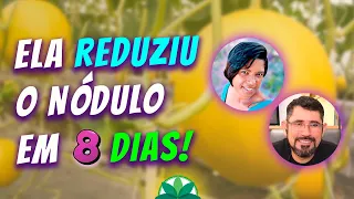 Ela reduziu os nódulos em apenas 8 dias! De mioma a tireoide, veja que plantas usar!