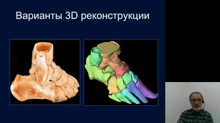 Лучевая диагностика 3.Лучевая диагностика опорно-двигательной системы