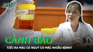 Màu Sắc Nước Tiểu Bất Thường Nói Lên Điều Gì Về Cơ Thể Bạn? Nguyên Nhân, Biểu Hiện Và Hậu Quả | SKĐS