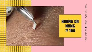 #152 | Huong Da Nang