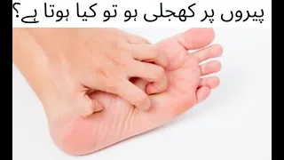 Pair mein Khujli Hone ka Kya matlab Hota hai|What does itching in the feet mean?|Hindi|Urdu