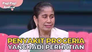 Cerita Puspa Yang Terkena Penyakit Langka Hingga Timbul Penuaan Dini | PAGI PAGI AMBYAR (3/11/22) P3