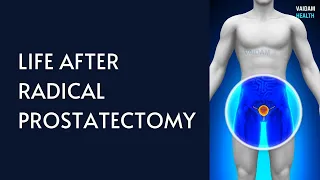 Life After Radical Prostatectomy