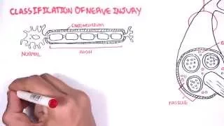 Neurology - Nerve Damage and Regeneration