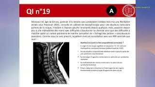 Conférence EDN 2023 - Neurologie Neurochirurgie