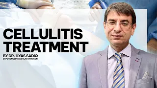 Cellulitis Ka Ilaj in Urdu / Hindi Dr. Illas Sadiq Vascular Surgeon