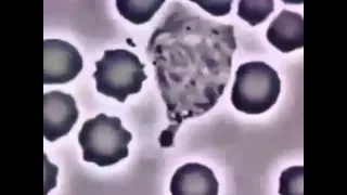 Neutrophil vs. Staphlococcus Aureus bacteria - phagocytosis