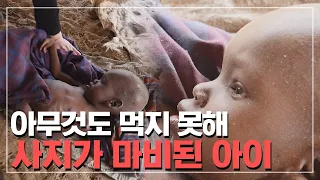 아무것도 먹지 못해 사지가 마비된 아이