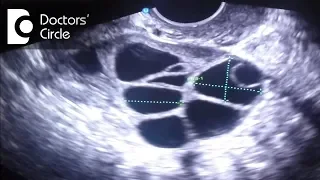 What do follicle size change in follicular study scan signify? - Dr. Teena S Thomas