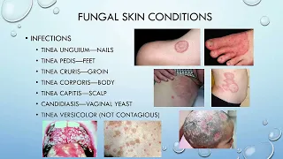 3  Dermatological Conditions   Fungal and Viral Skin Conditions