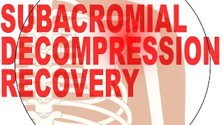 Shoulder Surgery Subacromial Decompression Recovery Protocol