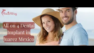 All on 4 Dental Implants in Juarez, Mexico