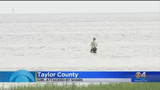 Teenage girl seriously injured in shark attack in Florida