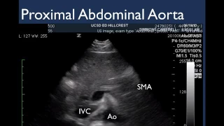 Aorta & IVC MS US Module