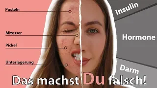 UNREINE Haut trotz GESUNDER Ernährung? So wirst du sie wirklich los!