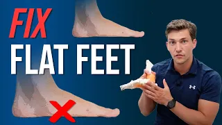 How to Fix Flat Feet WITHOUT Insoles!