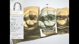 Intro to Dental CAD/CAM - The Tools