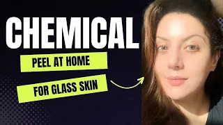 How to do a Chemical peel at home I How to use peeling solution the ordinary