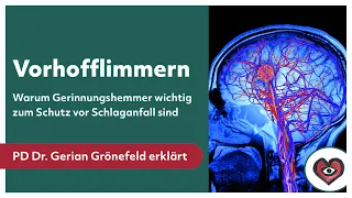 Vorhofflimmern: Warum Gerinnungshemmer wichtig zum Schutz vor Schlaganfall sind