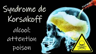 Les dangers de l'alcool sur le cerveau: syndrome de Wernicke- Korsakoff: un témoignage