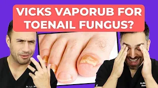 Ointment To CURE Toenail Fungus? | Doctorly Investigates