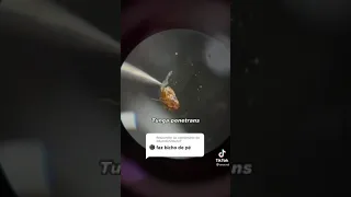 bicho de pé no microscópio, vídeos do tiktok.