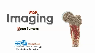 Bone Tumors ..Prof.mamdouh Mahfouz (2019 edition)