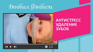 Антистресс удаление зубов❤️Хотите для своего ребёнка такой же внимательный и нестандартный подход❓