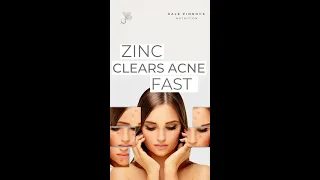 Zinc Clears Acne FAST!!