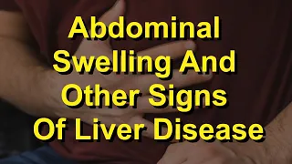 Abdominal Swelling And Other Signs Of Liver Disease