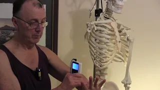 RIO Stroke Recovery use of electrical stimulation for shoulder subluxation