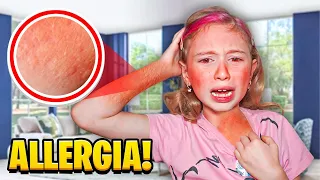 GIORGIA HA AVUTO UNA REAZIONE ALLERGICA CON PAPÀ SALVO!  *ANDIAMO AL PRONTO SOCCORSO*