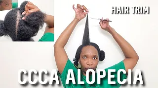 CCCA Alopecia Hair & Scalp Care | Hair Trim & Update #alopecia