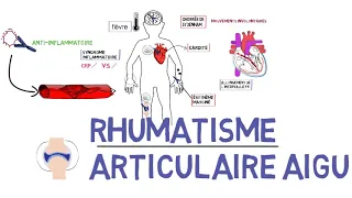 Rhumatisme articulaire aigu _RAA_de A à Z